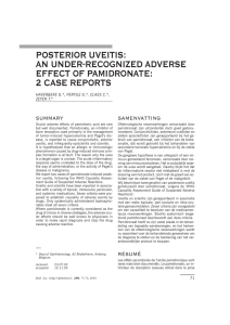 POSTERIOR UVEITIS: AN UNDER