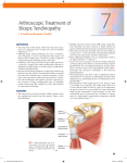 Arthroscopic Treatment of Biceps Tendinopathy