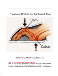 Treatment Choices For Contracted Toes