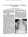 a case of congenital idiopathic hypertrophy of the heart