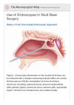 Use of Endoscopes in Skull Base Surgery