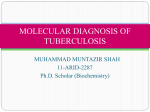 Mdr and xdr tuberculosis