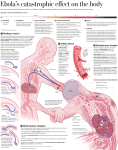 Ebola`s catastrophic e ect on the body