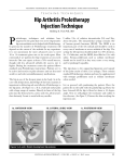 Hip Arthritis Prolotherapy Injection Technique