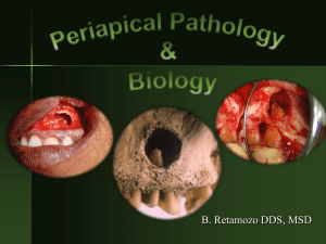 Asymptomatic Apical Periodontitis