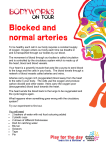 Blocked and normal arteries