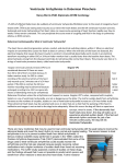 Ventricular Arrhythmias in Doberman Pinschers