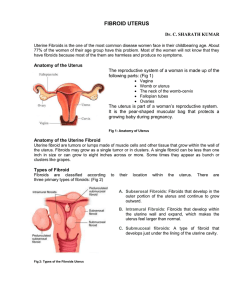 Health Vision Article fibroid uterus For March-16