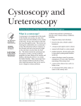 Cystoscopy and Ureteroscopy - ENID Urology Associates, Inc.
