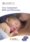 Your Caesarean Birth and Recovery