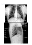 Chest X Rays