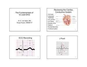 The Fundamentals of 12 Lead EKG Reviewing the Cardiac