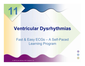 Ventricular Dysrhythmias (Fast and Easy ECGs, Shade / Wesley)