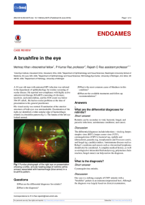 A brushfire in the eye