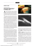 Anterior Segment Optical Coherence Tomography as a Diagnostic