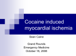 Cocaine induced myocardial ischemia