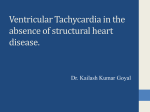 VT IN ABSENCE OF STRUCTURAL HEART DISEASE BY DR