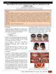 treatment of class ii malocclusion in adolescent by “forsus frd”