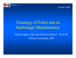 Tetralogy of Fallot and its Radiologic Manifestation