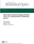 Hyperspectral optical imaging of human iris in vivo: characteristics of