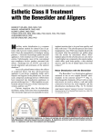 Esthetic Class II Treatment with the Beneslider and Aligners