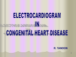 ECG IN CHD - Cardiology