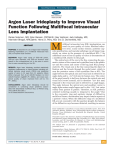Argon laser iridoplasty to improve visual function following multifocal