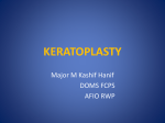 keratoplasty - howMed Lectures