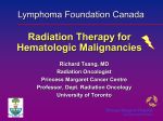 Radiation Therapy for Hematologic Malignancies