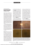 Spectral-Domain Optical Coherence Tomography of White Dot Fovea