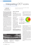 Interpreting OCT scans