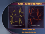 CRT: FU - ECG Analysis
