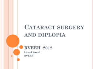 Cataract surgery and diplopia