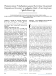 Photoreceptor Perturbation Around Subretinal Drusenoid Deposits