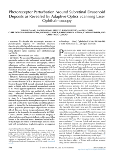 Photoreceptor Perturbation Around Subretinal Drusenoid Deposits