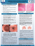 GI tract, Liver and Pancreatic tumors ,TMC, Kolkata