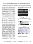 alternative splicing of type ii procollagen gene in the