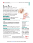 Patient Page on Ovarian Cancer
