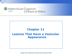 Lesions that Appear as Vesicles