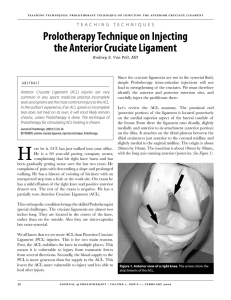 Prolotherapy Technique on Injecting the Anterior Cruciate Ligament