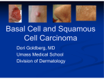 Basal Cell and Squamous Basal Cell and Squamous Cell Carcinoma