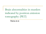 Brain abnormalities in murders indicated by positron emission