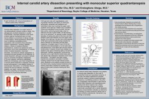Internal carotid artery dissection presenting with monocular