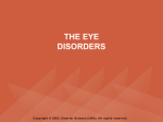 eyedisorder