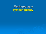 Cartilage Tympanoplasty