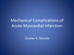 Mechanical Complications of Acute Myocardial Infarction