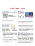Cancer of the Larynx - MUHC Patient Education