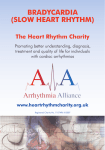 Bradycardia - Arrhythmia Alliance