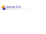 Normal ECG