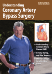 Understanding Coronary Artery Bypass Surgery
